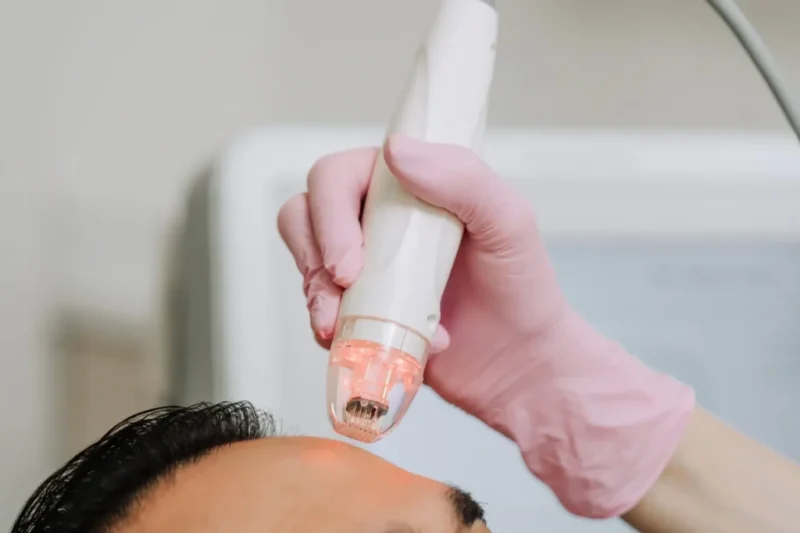 Skin Texture, Laxity and Volume Loss: Where RF Microneedling Fits